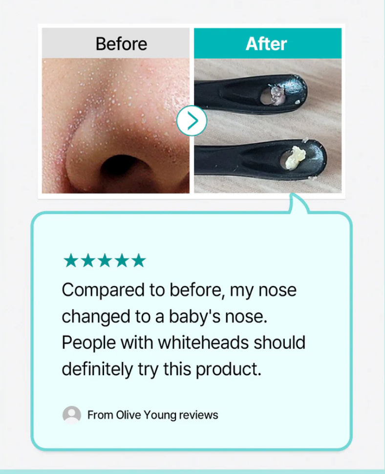 ILSO Natural Mild Clear Nose Patch - 5pc